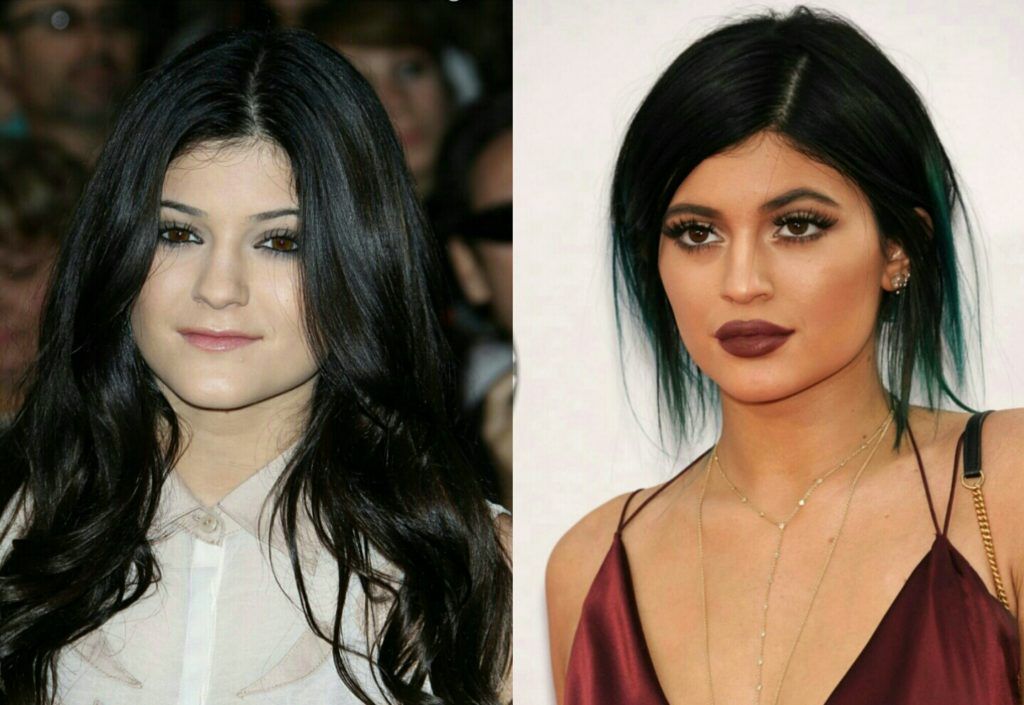 ¡Los mayores complejos de celebridades finalmente se dieron a conocer! Quotes